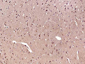 STK32C Rabbit Polyclonal Antibody