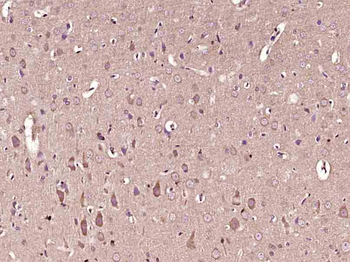 STK32C Rabbit Polyclonal Antibody