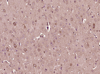 STRC Rabbit Polyclonal Antibody