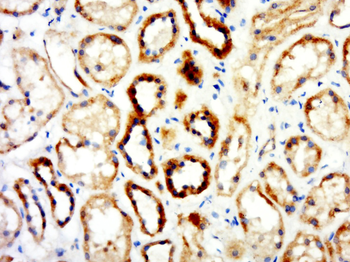 SCN1A Rabbit Polyclonal Antibody
