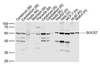 SOCS7 Rabbit Polyclonal Antibody