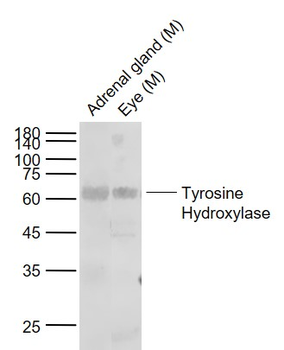 Tyrosine Hydroxylase Rabbit Polyclonal Antibody
