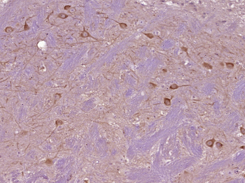 TIMM50 Rabbit Polyclonal Antibody