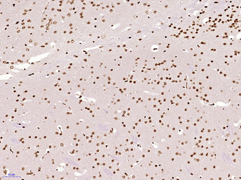 TINP1/NSA2 Rabbit Polyclonal Antibody