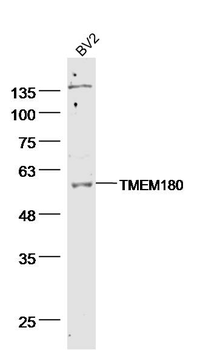TMEM180 Rabbit Polyclonal Antibody