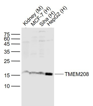 TMEM208 Rabbit Polyclonal Antibody
