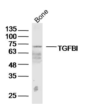 TGFBI Rabbit Polyclonal Antibody