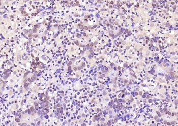 Ubiquitin Rabbit Polyclonal Antibody