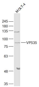 VPS35 Rabbit Polyclonal Antibody