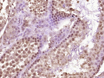 VRTN Rabbit Polyclonal Antibody