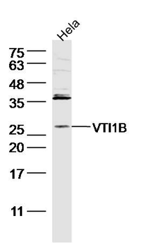 VTI1B Rabbit Polyclonal Antibody