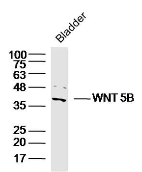 WNT 5B Rabbit Polyclonal Antibody