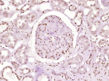 ZNF670 Rabbit Polyclonal Antibody