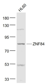 ZNF84 Rabbit Polyclonal Antibody