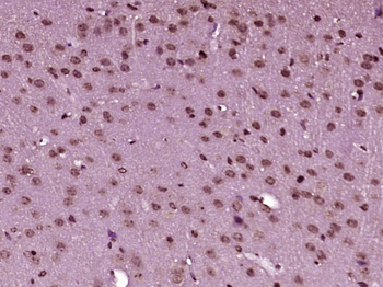 ZNF182 Rabbit Polyclonal Antibody