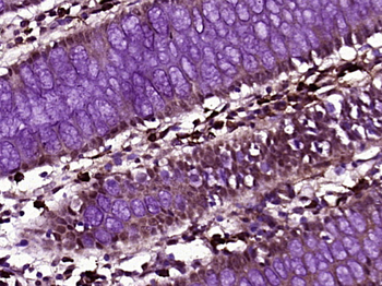 ZNF197 Rabbit Polyclonal Antibody