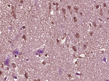 ZNF214 Rabbit Polyclonal Antibody