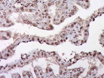 ZNF22 Rabbit Polyclonal Antibody