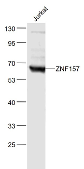 ZNF157 Rabbit Polyclonal Antibody