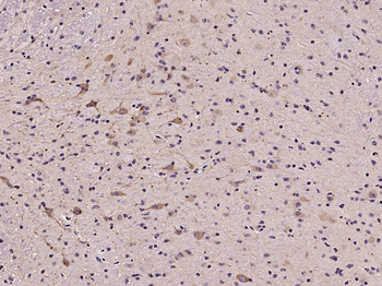 Sema3A Rabbit Polyclonal Antibody