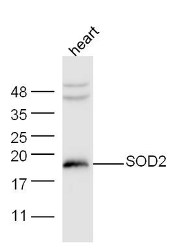 SOD2 Rabbit Polyclonal Antibody