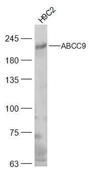 ABCC9 Rabbit Polyclonal Antibody