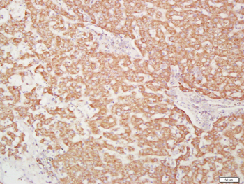 CXCR4 Rabbit Polyclonal Antibody