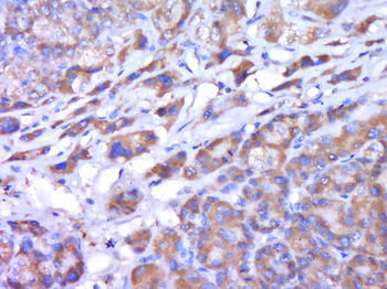 CYP2C19 Rabbit Polyclonal Antibody