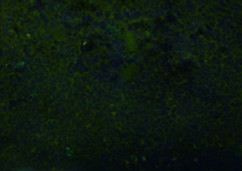 CD68 Rabbit Polyclonal Antibody