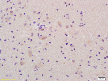 FOLR2 Rabbit Polyclonal Antibody