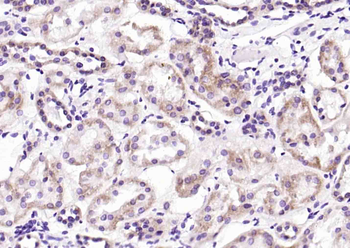Iduronate 2 sulfatase Rabbit Polyclonal Antibody