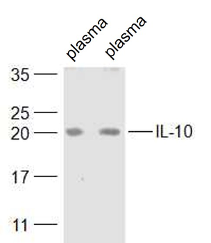 IL-10 Rabbit Polyclonal Antibody