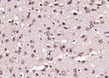 LC3A/B + LC3B + LC3C Rabbit Polyclonal Antibody