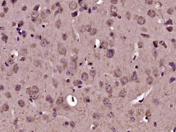 NUFIP2 Rabbit Polyclonal Antibody