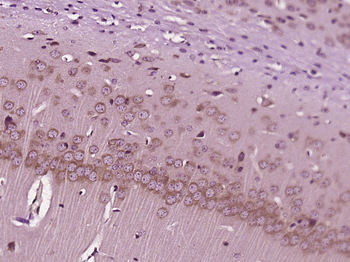 PTPLB Rabbit Polyclonal Antibody