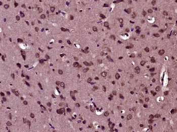 PTPN20 Rabbit Polyclonal Antibody