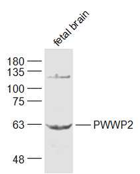 PWWP2 Rabbit Polyclonal Antibody