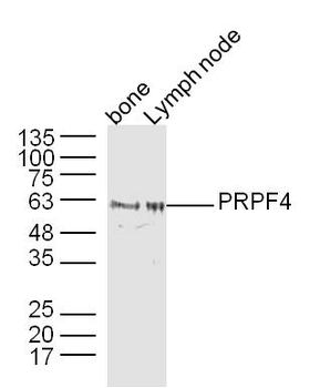 PRPF4 Rabbit Polyclonal Antibody