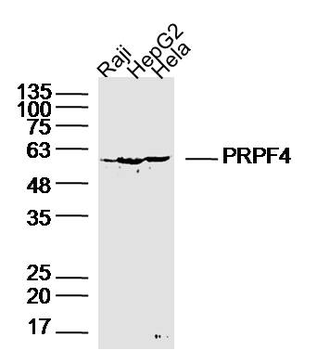 PRPF4 Rabbit Polyclonal Antibody