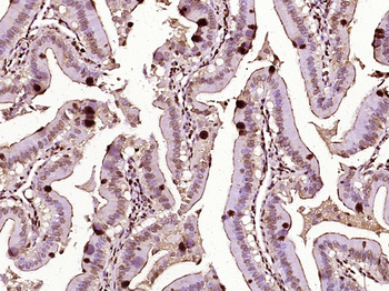 RAD51AP2 Rabbit Polyclonal Antibody