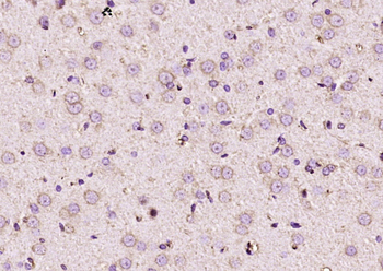 RARS2 Rabbit Polyclonal Antibody