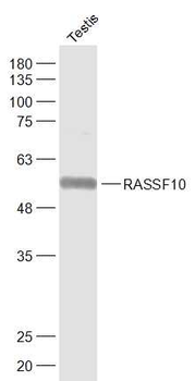 RASSF10 Rabbit Polyclonal Antibody