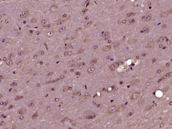 SEC61B Rabbit Polyclonal Antibody