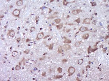 PLA2G2A Rabbit Polyclonal Antibody