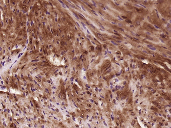 SH3D19 Rabbit Polyclonal Antibody