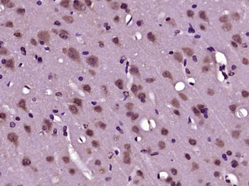 SLC25A33 Rabbit Polyclonal Antibody