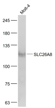SLC26A8 Rabbit Polyclonal Antibody