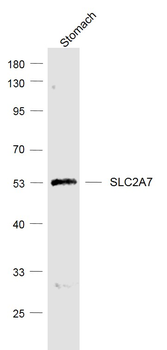 SLC2A7 Rabbit Polyclonal Antibody