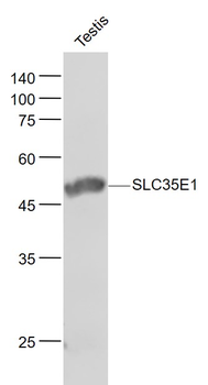 SLC35E1 Rabbit Polyclonal Antibody