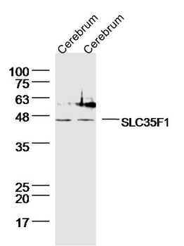 SLC35F1 Rabbit Polyclonal Antibody